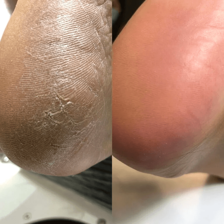 Кератолик для ног NAILSOFTHEDAY Podology+ (увлажняющий и питательный с мочевиной), 100 мл — 2